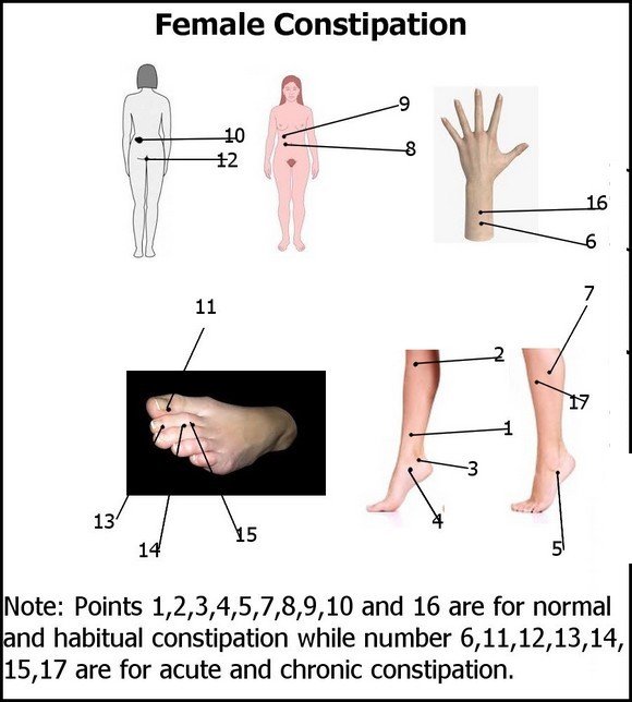 Constipation for Female