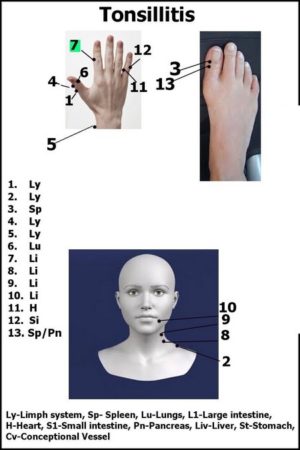 Cure Tonsillitis with Acupressure Treatment | Life style Health Fitness