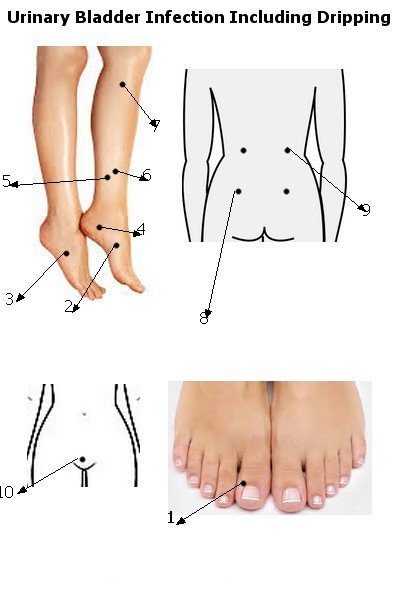 Urinary Bladder Infection