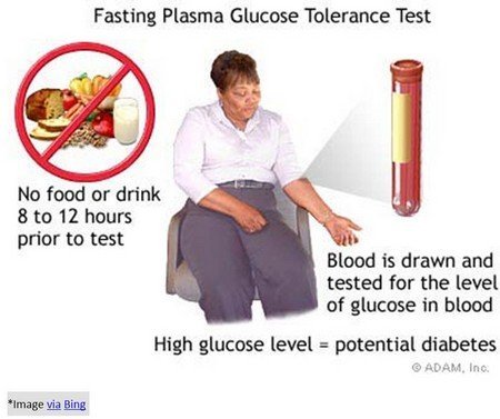 Fasting plasma glucose FPG test