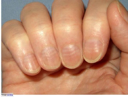 Changes-in-Nail-and-Skin