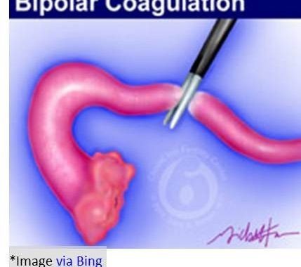 Coagulation-or-cauterization