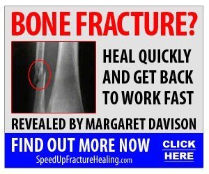 Fracture-Healing-Banner