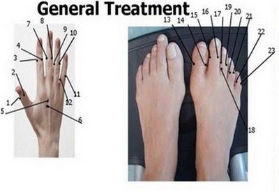General-acupressure-points-Treatment