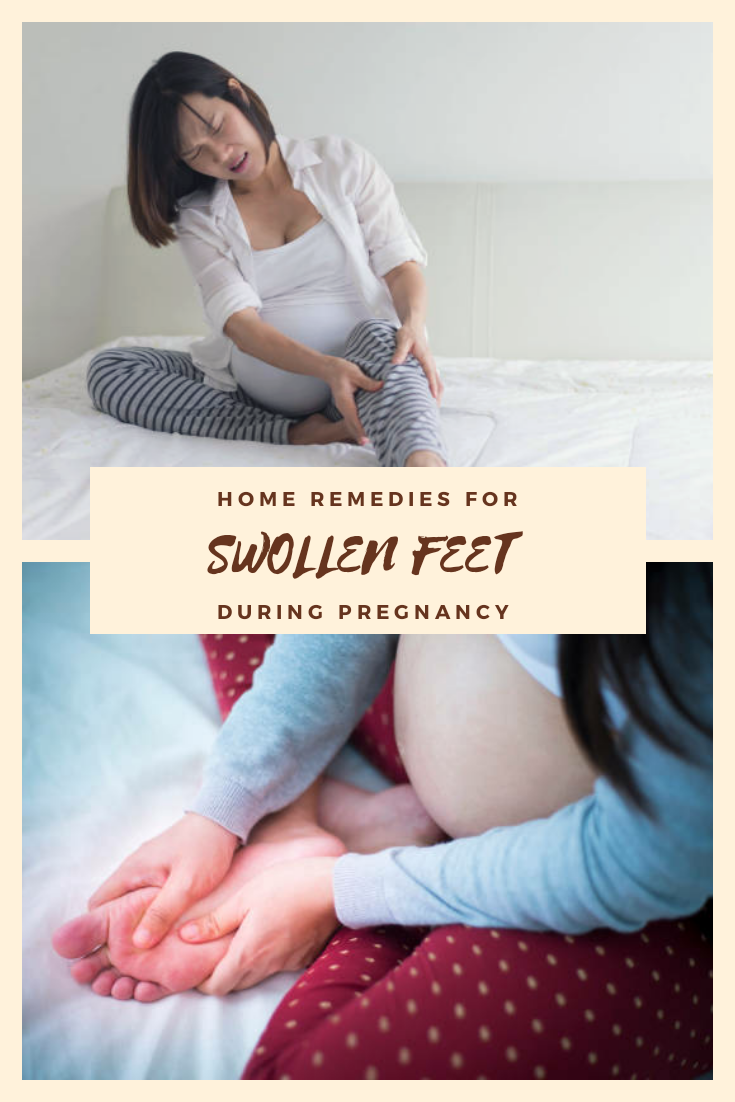 8 Home Remedies for Swollen Feet during Pregnancy
