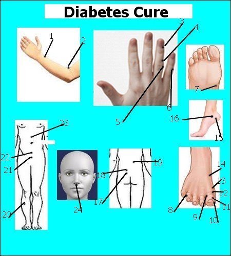 Diabetes-Pancreas