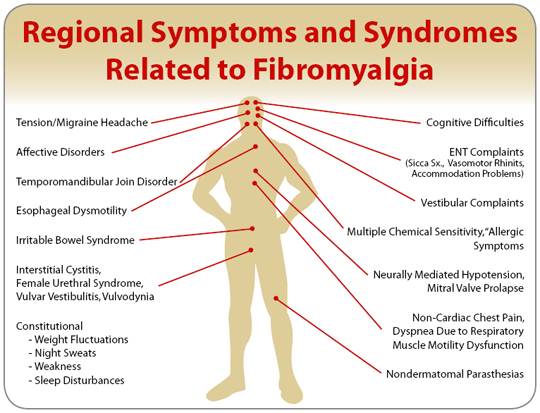 fibromyalgia