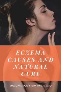 ECZEMA CURE