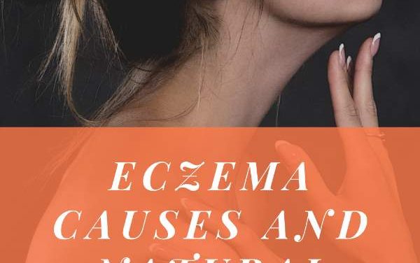 Eczema Cure and Causes