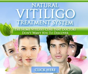 Vitiligo treatment system