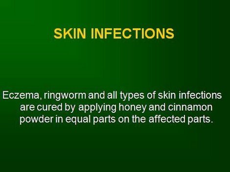 eczema infection