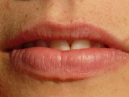 treatments of herpes