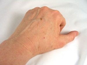 skin spots and patches