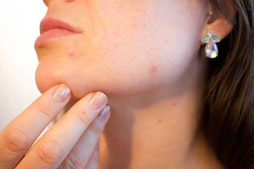 Discover Acne Reasons Before Acne Treatment