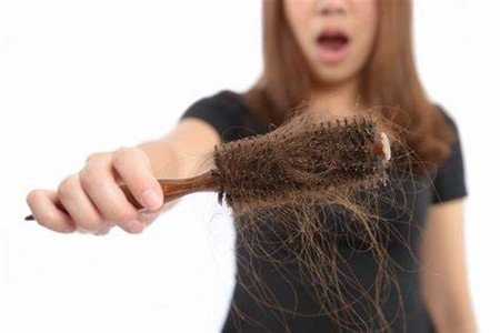 Hair Loss Among Young Women