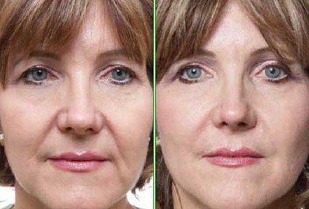 Tone Your Face Muscles With Face Exercises