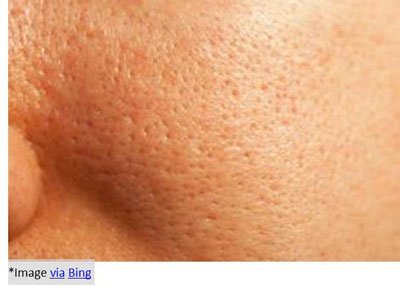 Enlarged-Pores