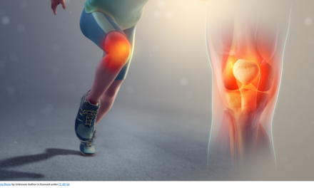 Precautions, Natural remedies and Exercises to Treat Knee Pain
