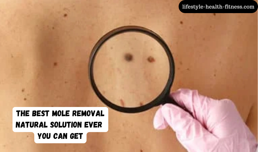 Natural mole removal