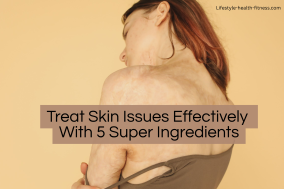 treat skin issues naturally