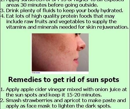 Get Rid of Sunspots with Home Remedies and Prevention Tips