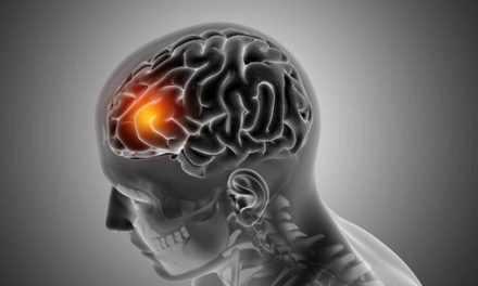 The Complete Guide to Glioblastoma in Older Adults and How it Affects the Brain