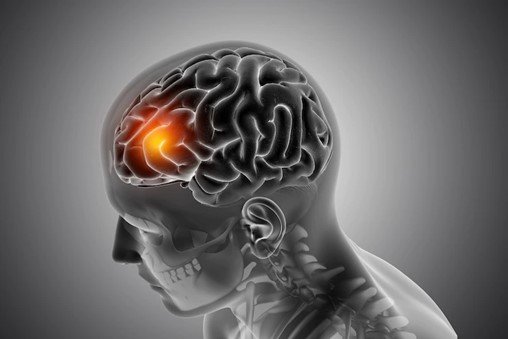 The Complete Guide to Glioblastoma in Older Adults and How it Affects the Brain