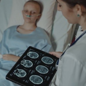 Glioblastoma treatment